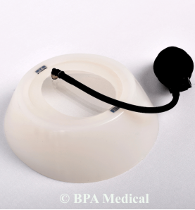 Vacuum Bell Küçük 19 cm – Pectus Excavatum İçin CE Belgeli Medikal Cihaz