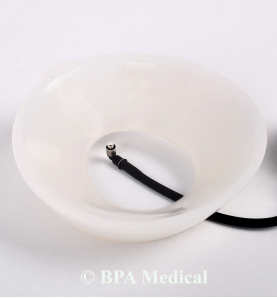 Vacuum Bell Küçük 19 cm – Pectus Excavatum İçin CE Belgeli Medikal Cihaz